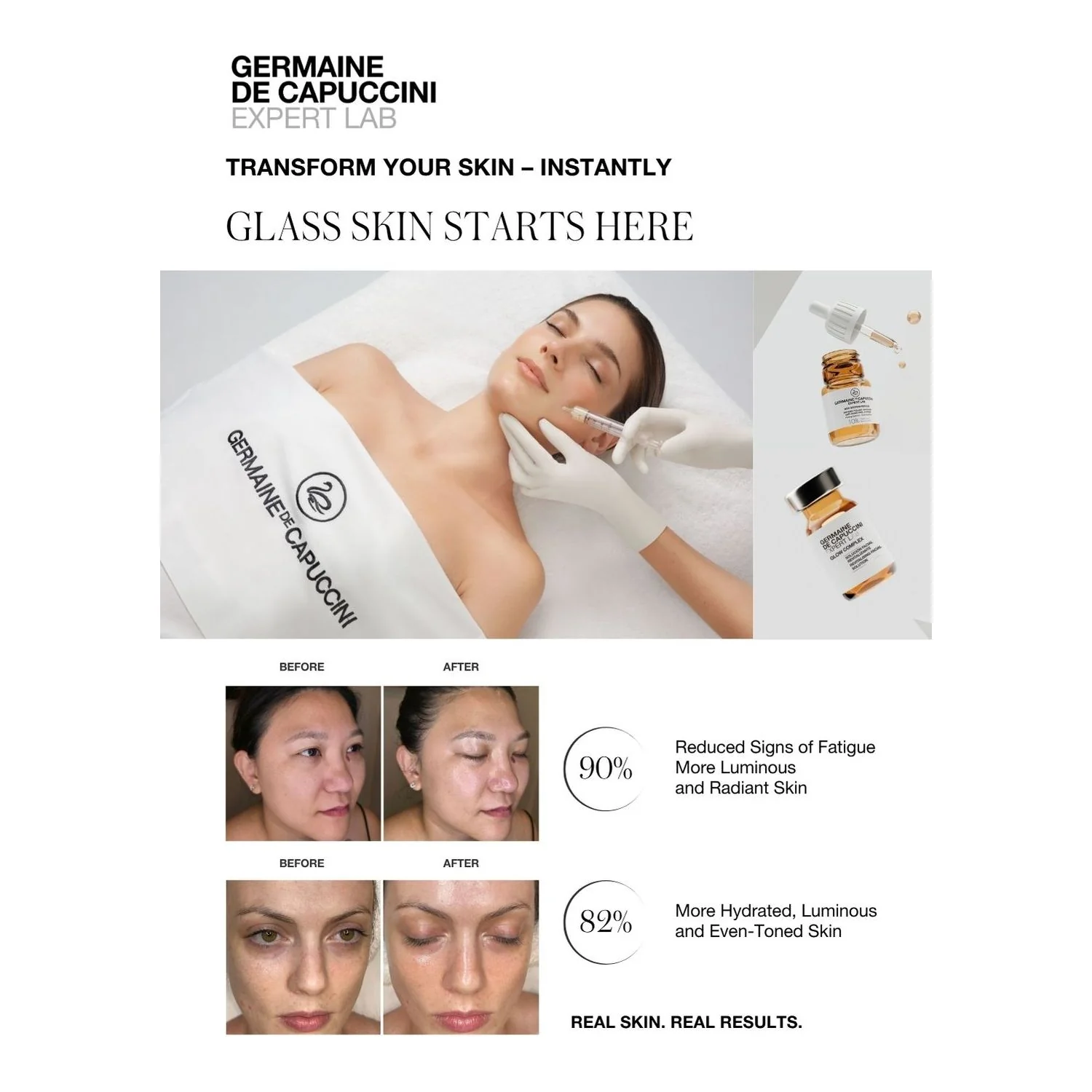 Glass Skin A4 Poster