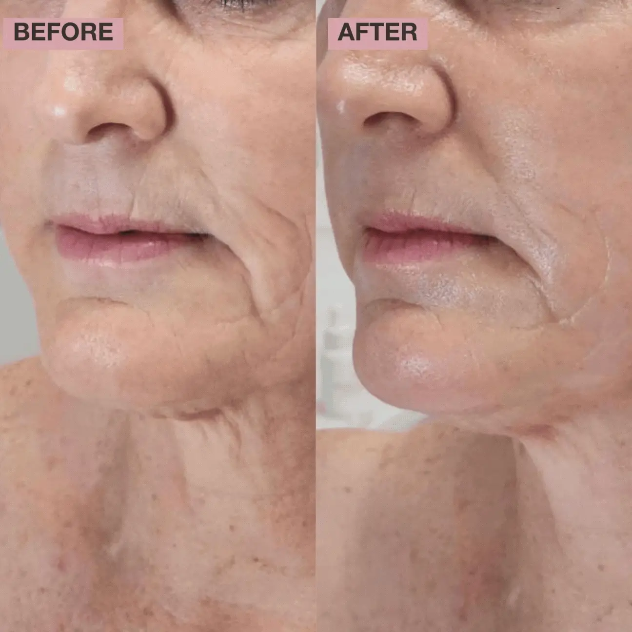 T Wrink Less Pro- Collagen Intensive Essence - Step 1 Ampoule