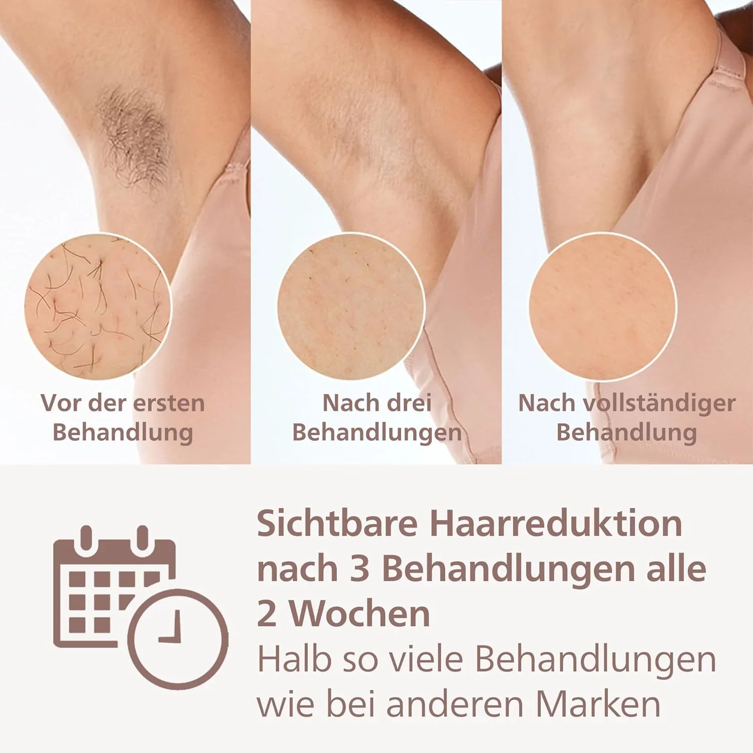 Philips Lumea IPL Haarentfernungsger?t 9000 Series �C Haarentfernungsger?t mit SenseIQ Technologie, 3 Aufs?tze f��r K?rper, Gesicht und Pr?zision, kabellos (Modell BRI955/00)