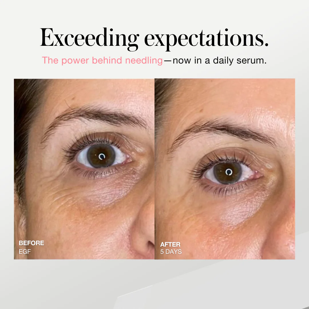 28-Day EGF Rejuvenation Program — Epidermal Growth Factor Skin Renewal