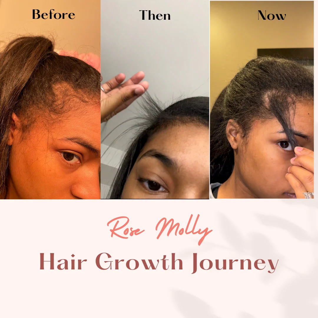 Ultimate Hair Growth Elixir