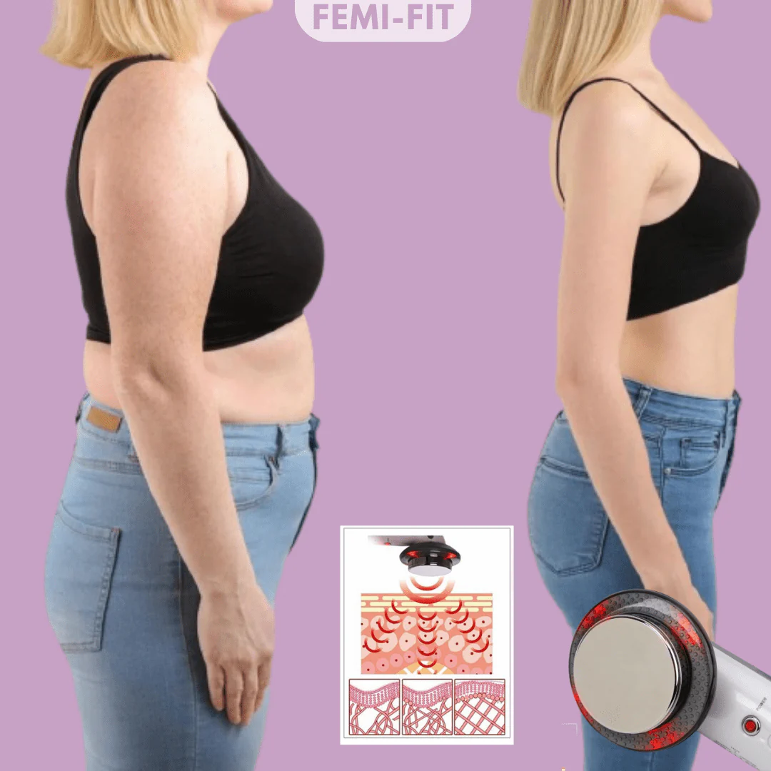 SLIMSHAPE – Quemador 3 en 1 de celulitis y grasa con EMS, ultrasonido e infrarrojos