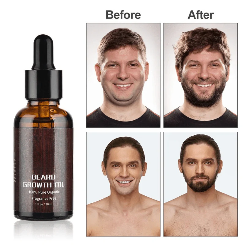 Bartboost – Kit para el crecimiento de la barba para una barba sana y fuerte