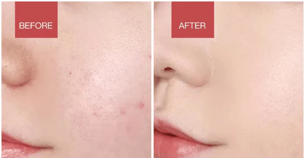 Glowpure – Limpiador facial eléctrico con luz LED y tecnología de calor a 42 °C | Dispositivo de cuidado de la piel de silicona con vibración sonora